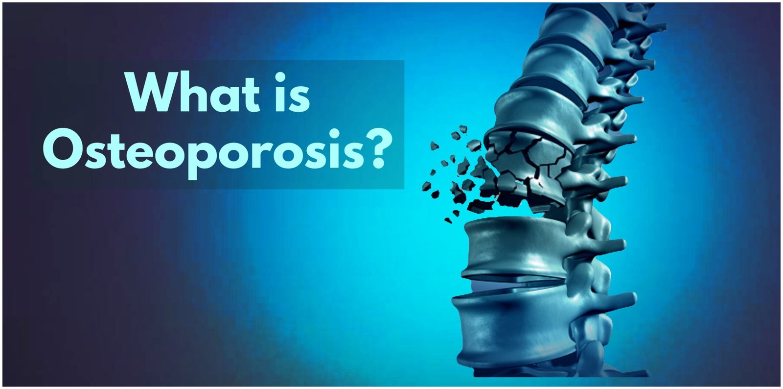Osteoporosis in seniors is the most common cases recorded.
