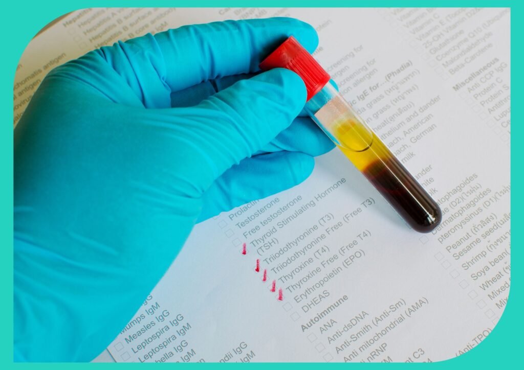 The thyroid test measures TSH and T4 levels, which regulate thyroid hormone production.
