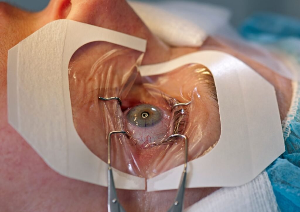 Eye surgery is decided after a thorough evaluation by an eye specialist who considers condition severity, benefits, and risks.