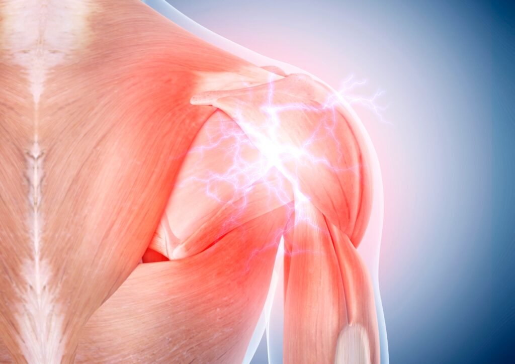 muscle pain due to nerve vitamin deficiency