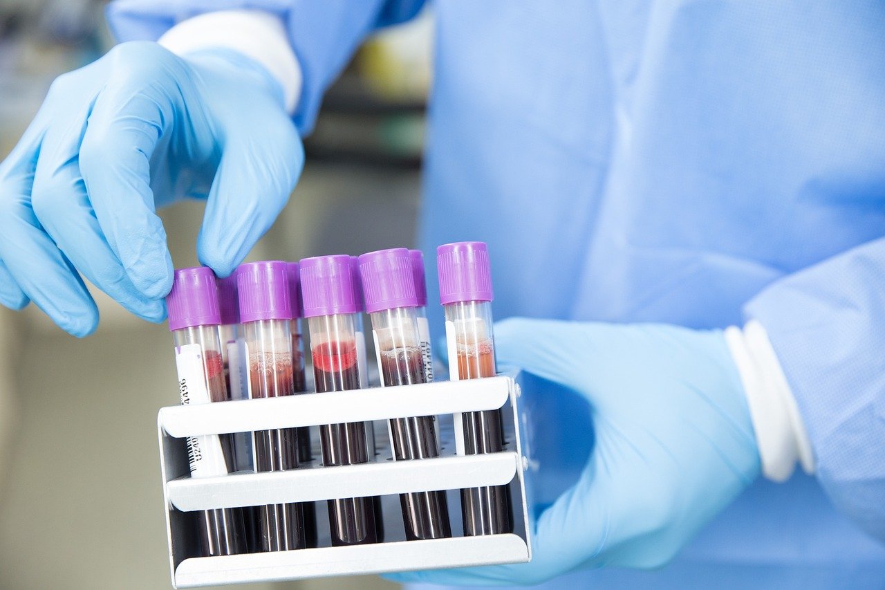 A Breakthrough in Alzheimer’s Detection: Simpler, Sooner, and More Accessible